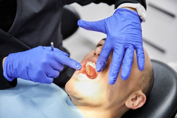 Best Emergency Gum Treatment in Three Way, TN